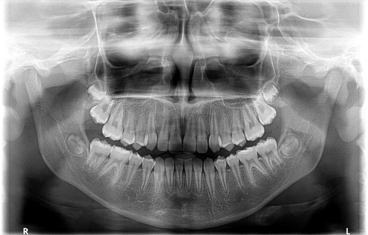 kodak imaging dental